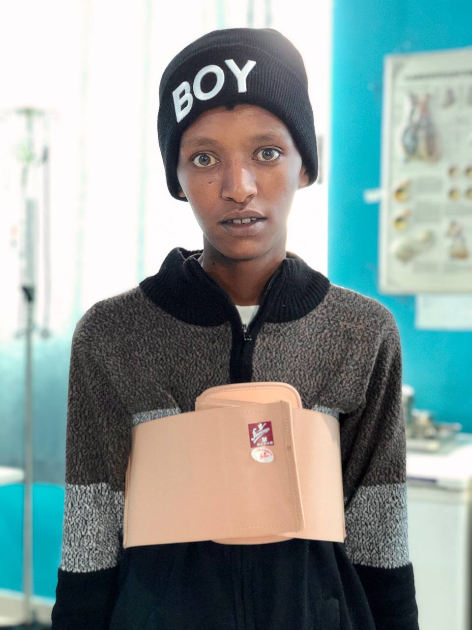 TEWODROS– HVE Second Patient
